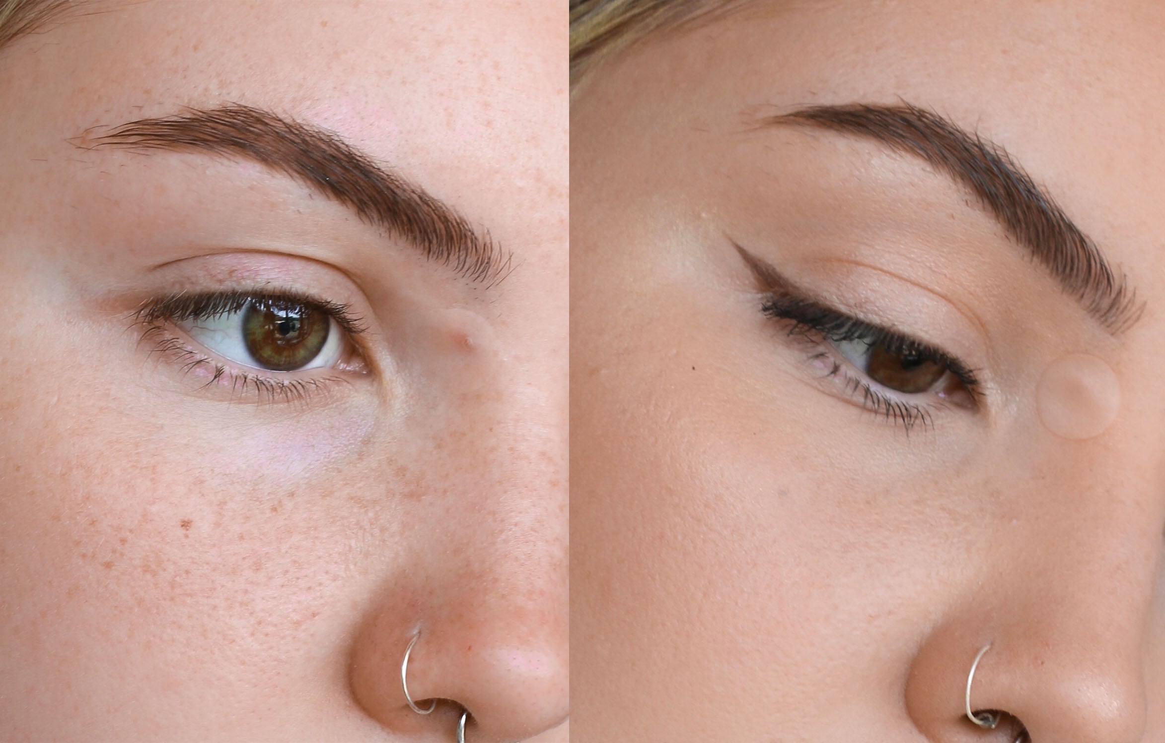 Makeup + Pimple Patches: Friends or Foes?